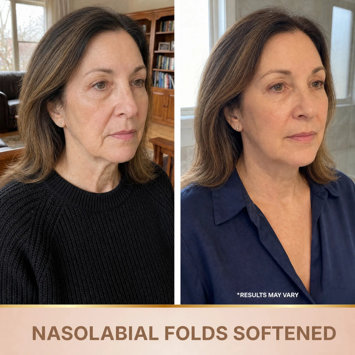Novalys – Korean Serum with a Lifting Effect from the Very First Application