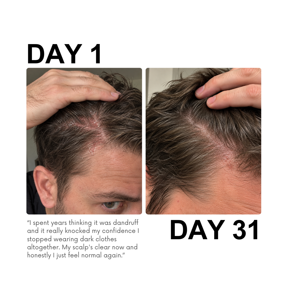 Novalys — Rescue & Reset Serum