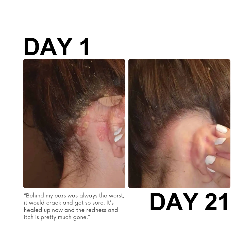Novalys — Rescue & Reset Serum