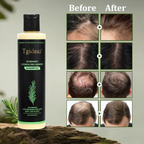 Novalys — Rosemary Shampoo | Hair Growth & Scalp Treatment