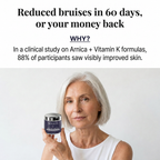 Novalys™ Bruise Repair & Skin — Strengthening Cream