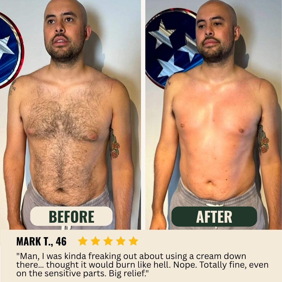 Novalys™ Hair Removal Cream