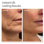 Novalys — Korean Instant Lift Serum