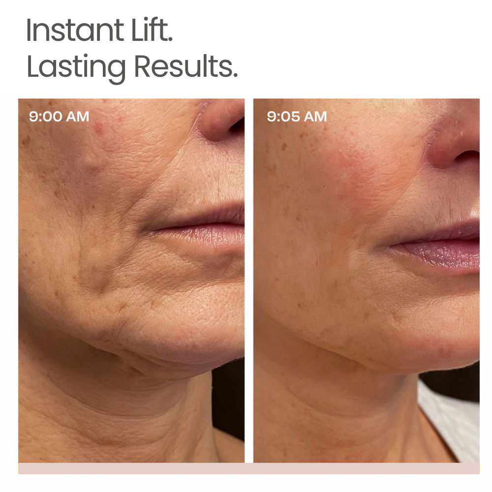 Novalys — Korean Instant Lift Serum