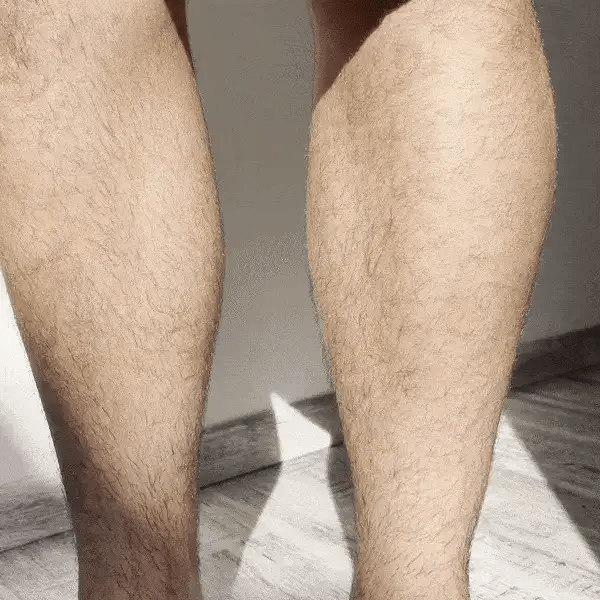 Novalys™ Hair Removal Cream