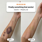 Novalys™ Bruise Repair & Skin — Strengthening Cream